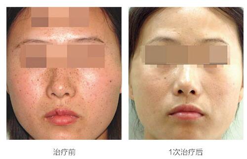 �Ͼ�����ȥȸ��ҽԺ���ѡ��