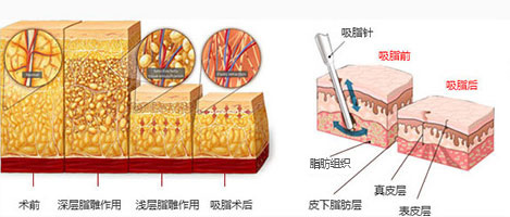 �Ͼ����β���֬��������Σ����?