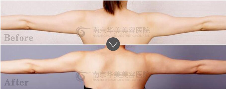 �Ͼ��ֱ���֬�ķ����Ƕ���?