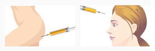 ����֬��