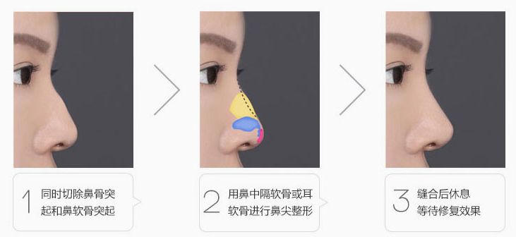 �Ͼ�������ӥ���ǽ�������?