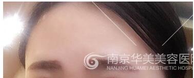 做纹眉要进行几次呢?