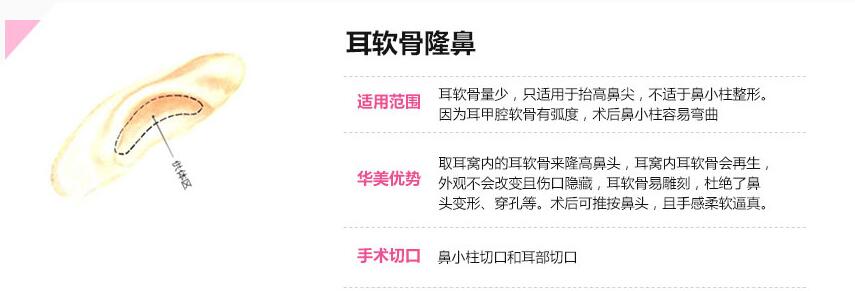 �Ͼ�����������¡��Ч����Σ�